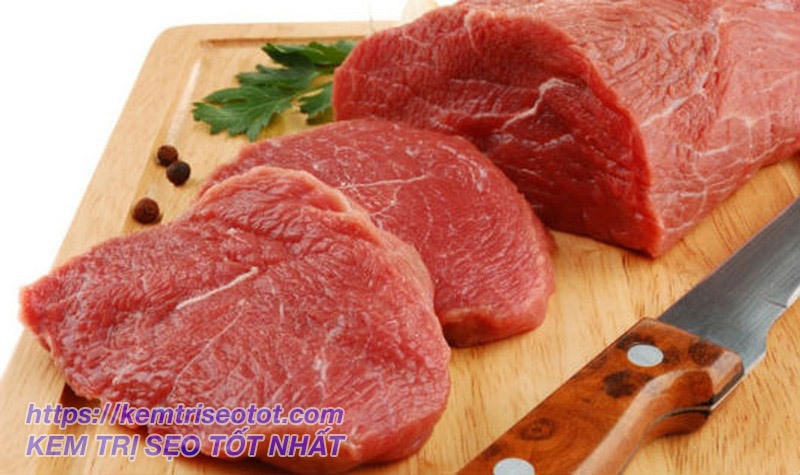 Kiêng ăn thịt bò để tránh bị sẹo thâm sau phẫu thuật